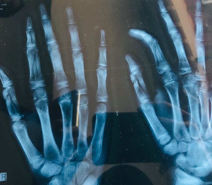Can any one please criticise this xray