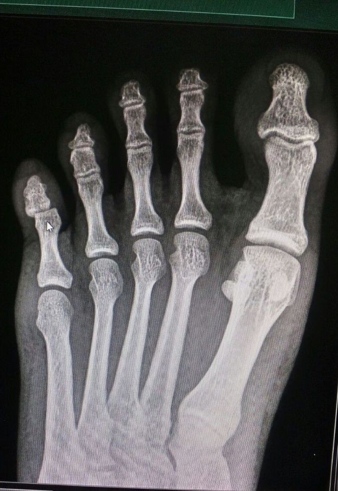 What is the diagnosis