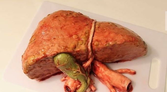 Liver anatomy