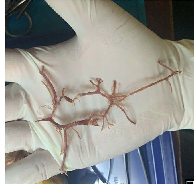 Circle of willis