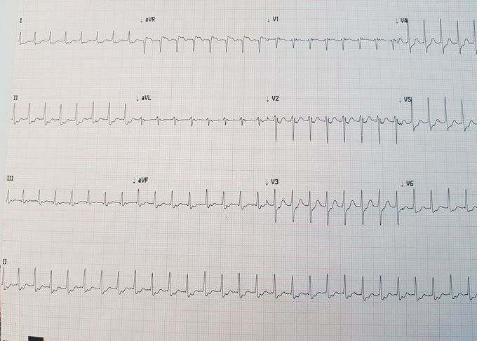 What's your diagnosis?