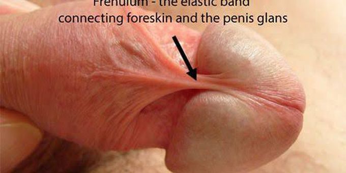 Management of frenulum breve