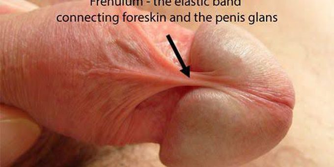 Management of frenulum breve