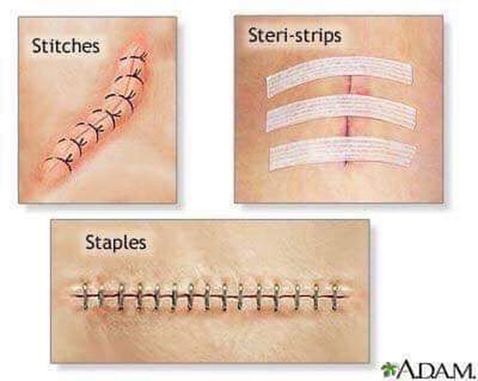 Types of  stictchs