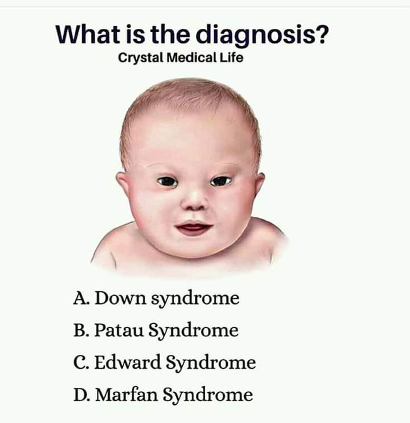 What is the diagnosis ? - MEDizzy