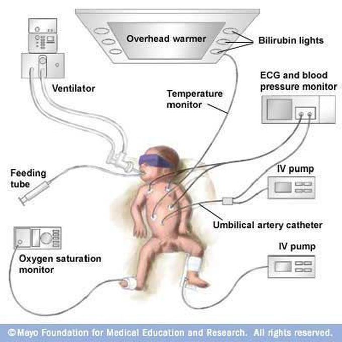 NICU. Care