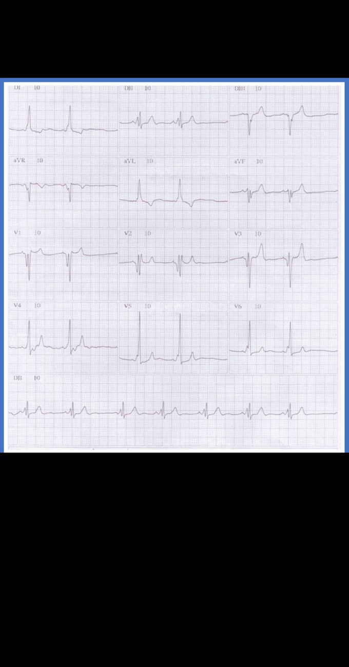 Diagnosis?