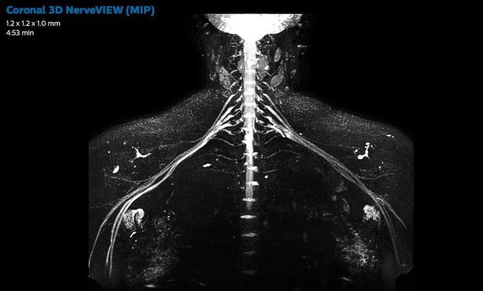 Non-invasive nerve plexus MR imaging