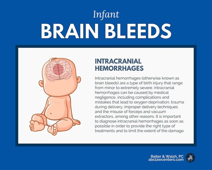 Symptoms of intracranial bleeding