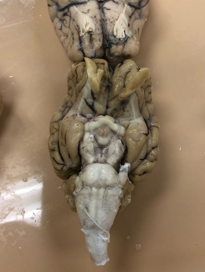 Sheep brain