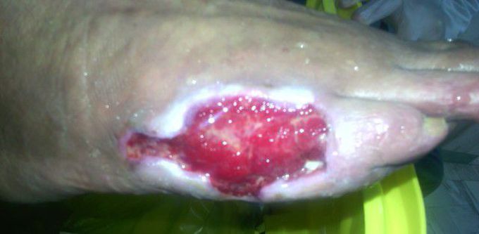 What is your diagnosis about this disease