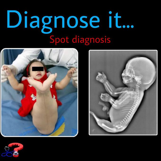 Spot Diagnosis