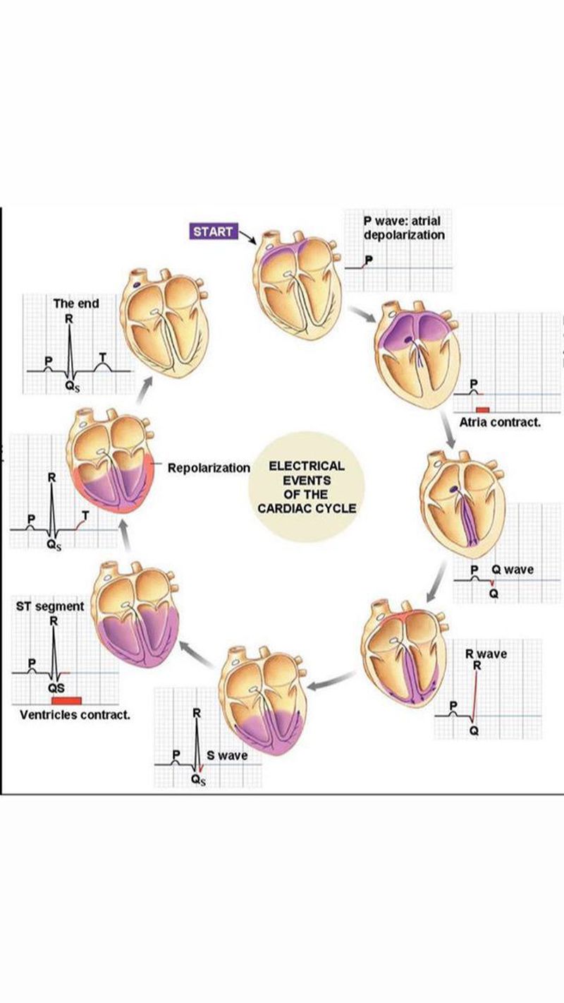 ECG.... - MEDizzy