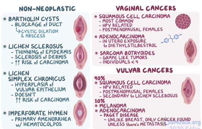 Vaginal and vulvar disorders