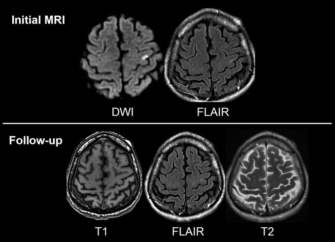 MRI differences