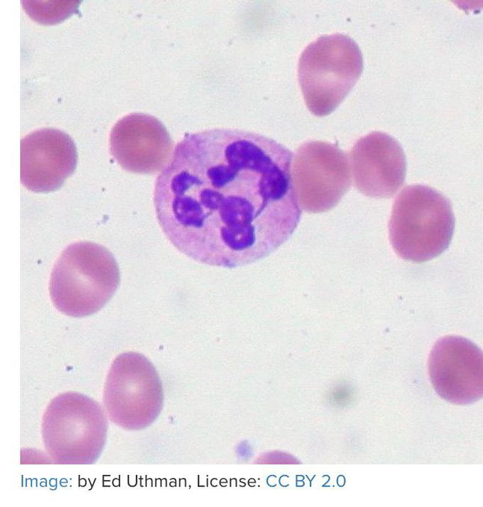 What’s the diagnosis most likely?