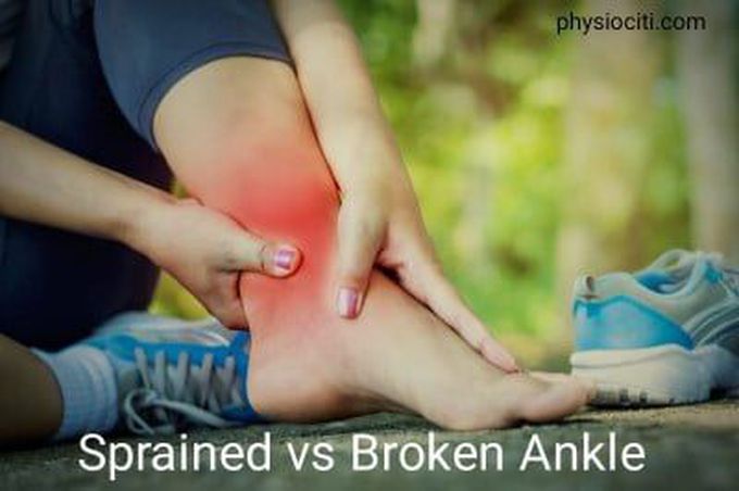 Sprained Ankle vs Broken Ankle: Symptoms & PT Management! - physiociti