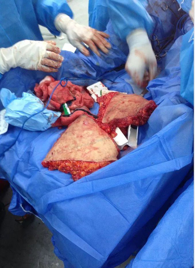 general surgery