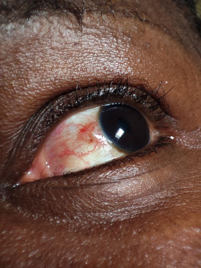 Eye diagnosis.