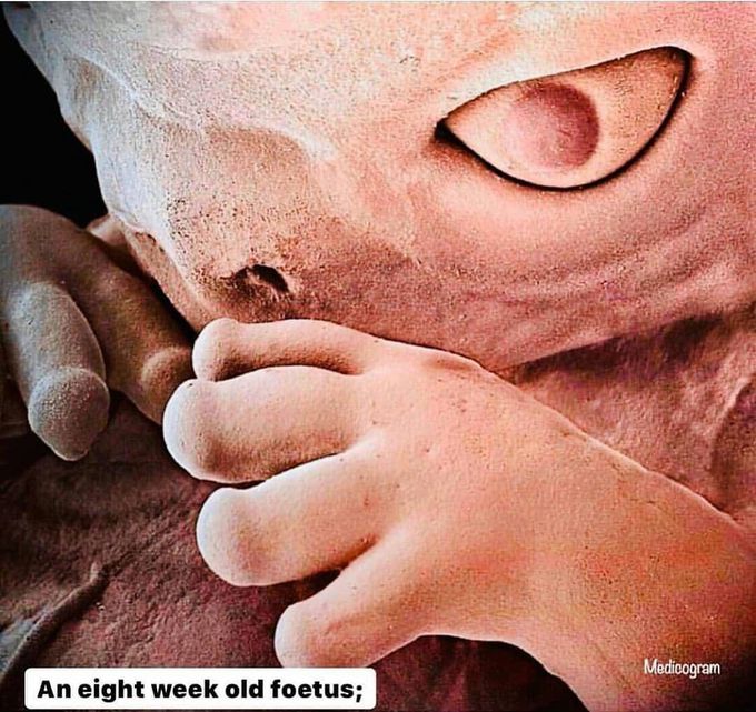An 8 week old foetus