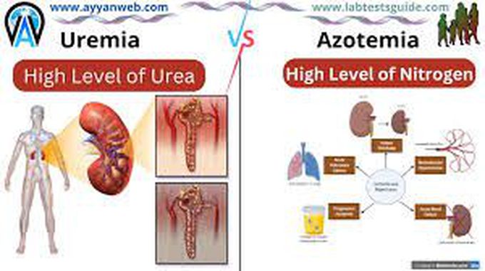 Azotemia vs uremia