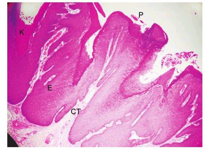 Oral papilloma
