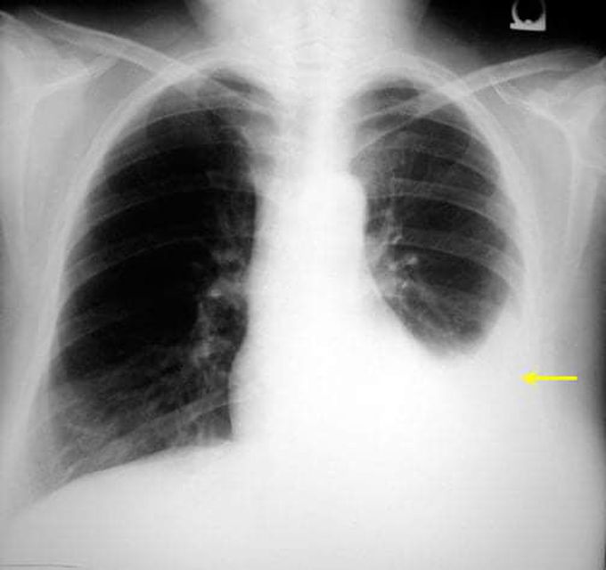 What's your diagnosis?