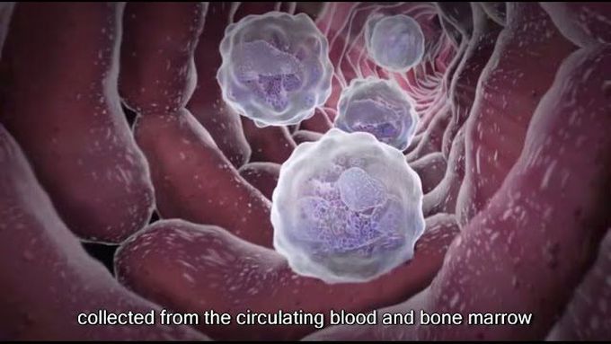 What is Bone Marrow Transplantation?