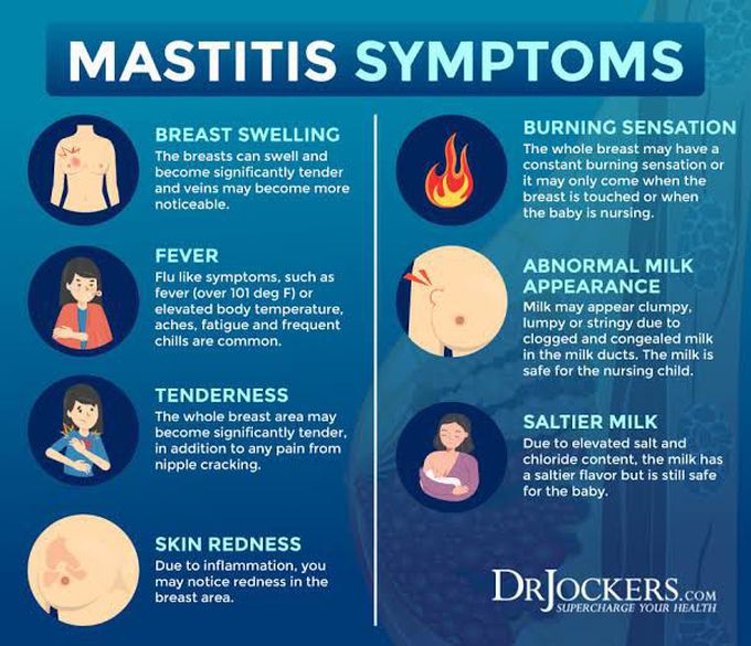 mastitis in women symptoms