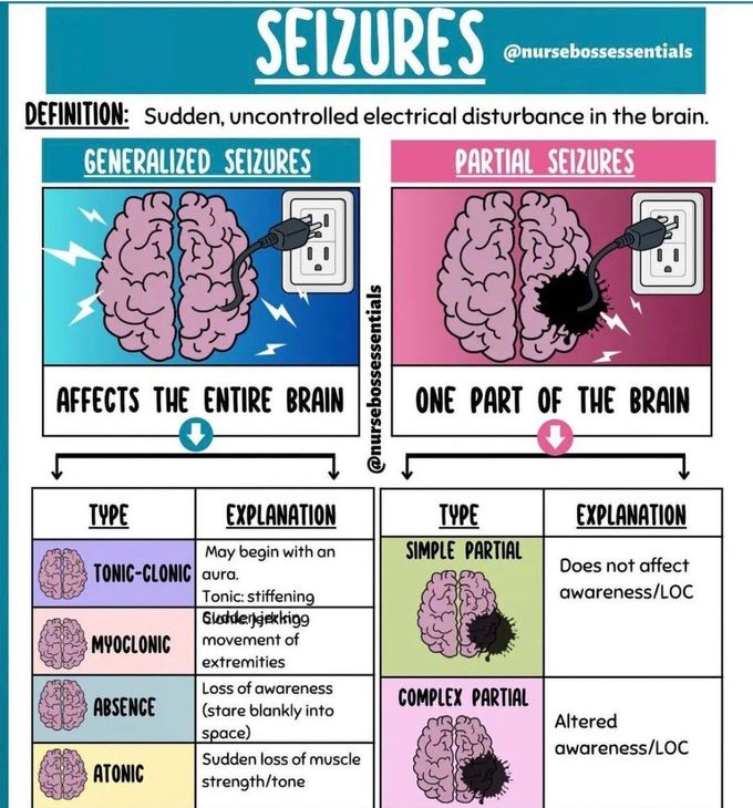 Seizures