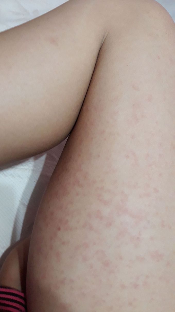 someone can tell me what this is and what caused it?