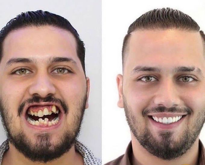 Orthodontic Magic