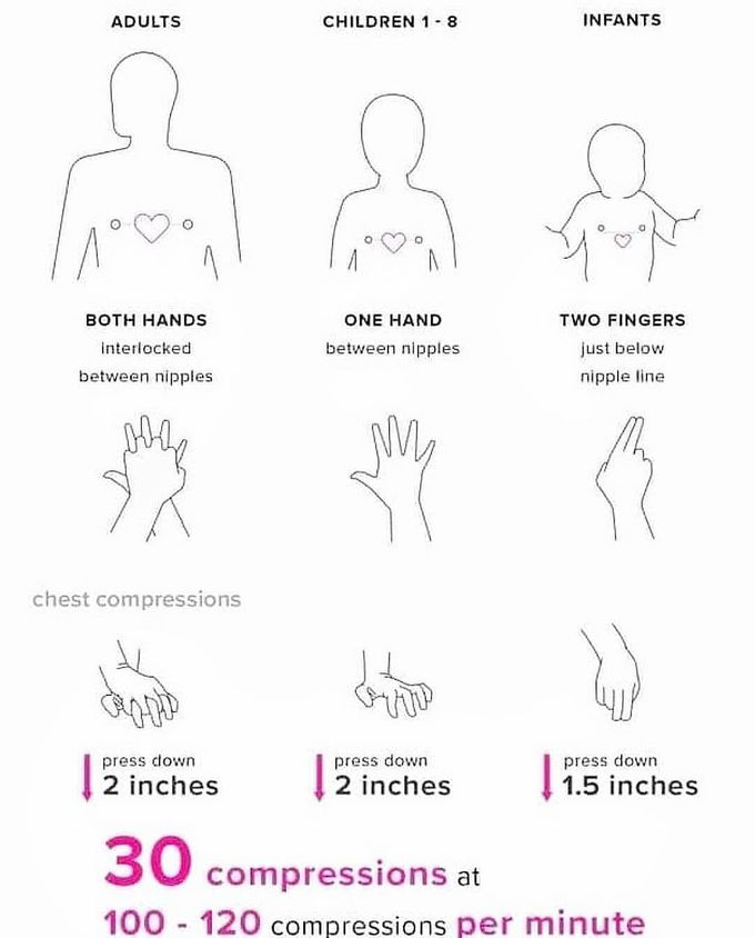 Compression CPR
