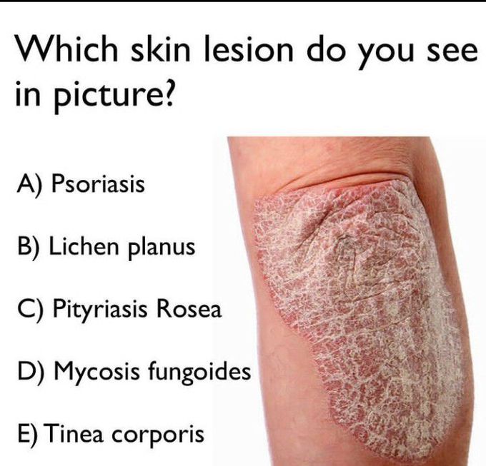Which skin lesion do you see?