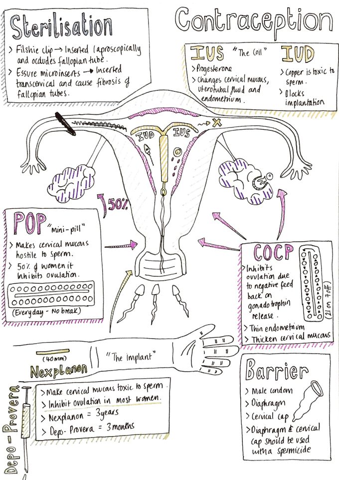 Contraception - Where do they work?