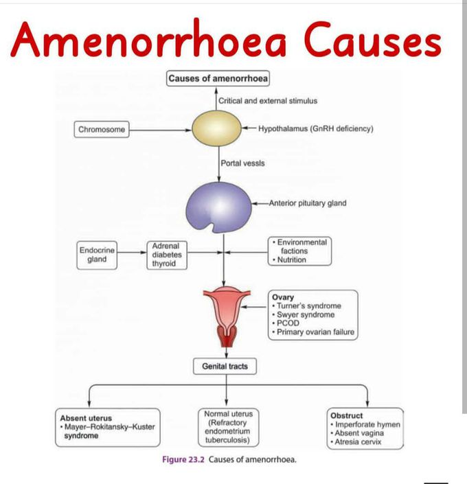 Amenorrhea