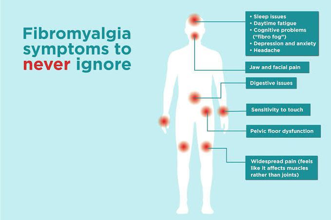 Fibromyalgia