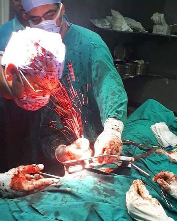 Blood bath while operating on a stab wound to the heart! 