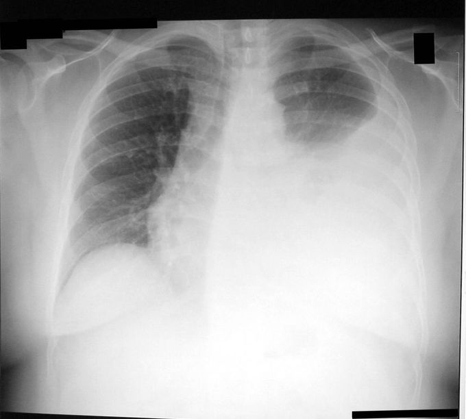 What is the diagnosis and treatment ?