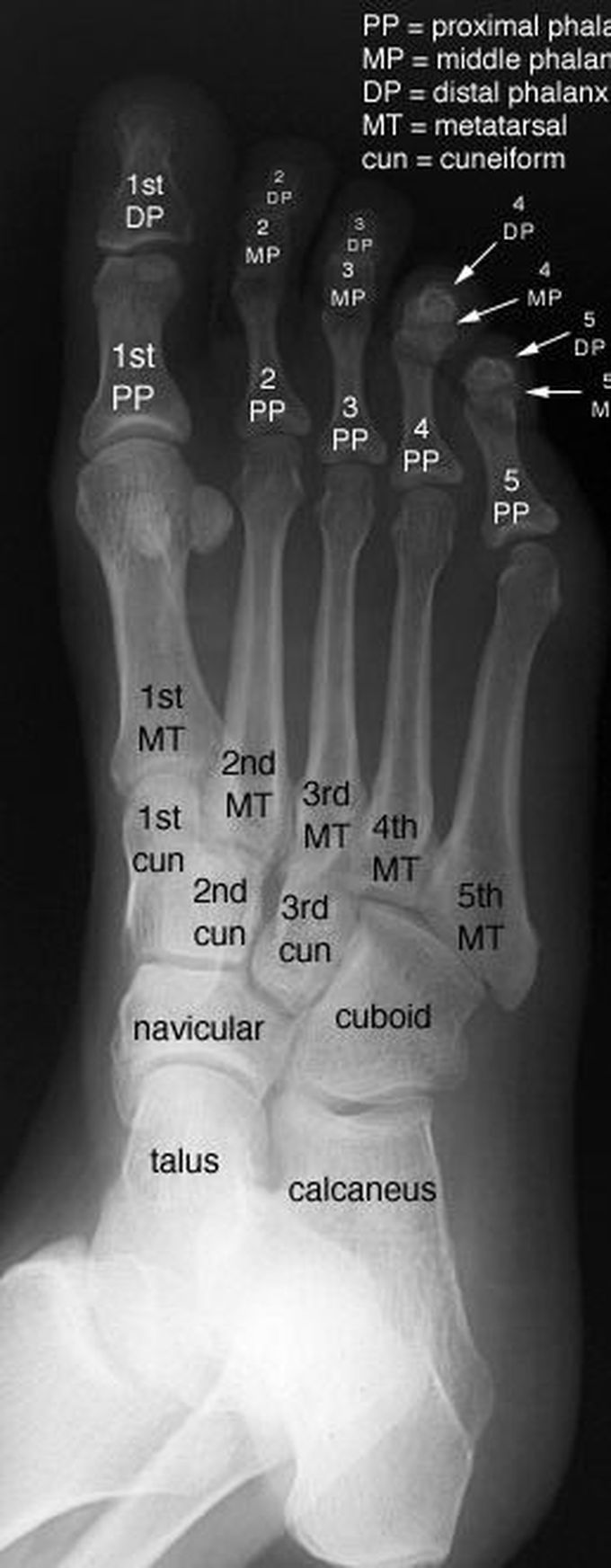 Anatomy of foot