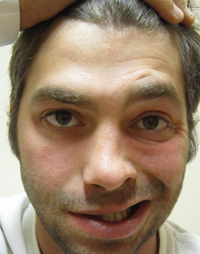 MEDICAL CASE