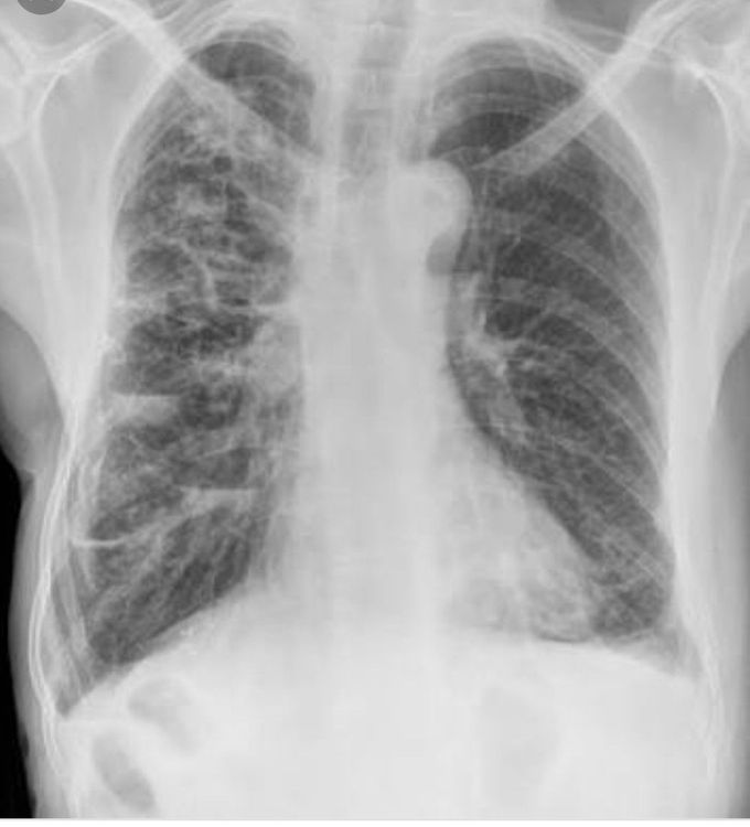 Diagnosis?