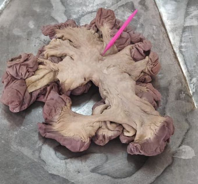 Mesentery of small intestine