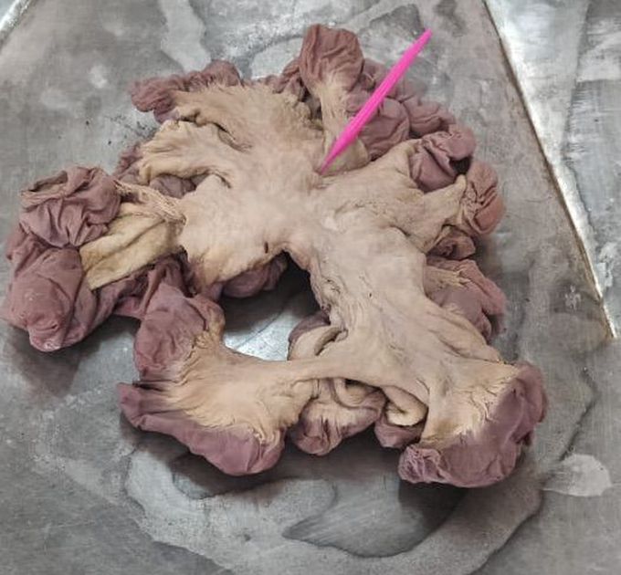 Mesentery of small intestine