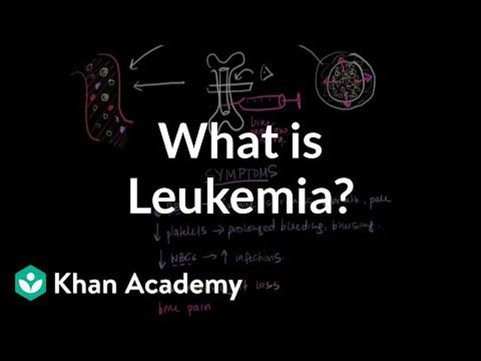 Leukemia: basic mechanism
