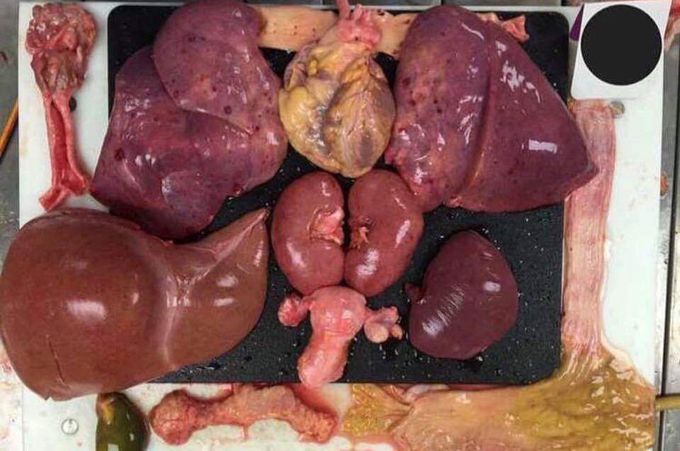 Human organs size