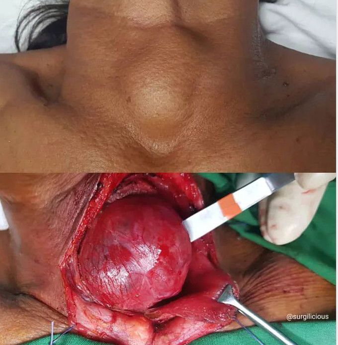 head and neck surgery