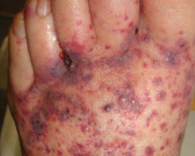 Diagnose??