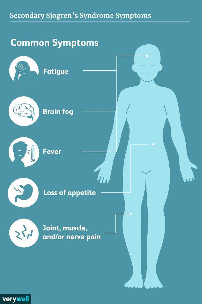 Sicca syndrome