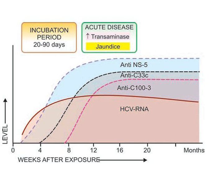 Hepatitis C